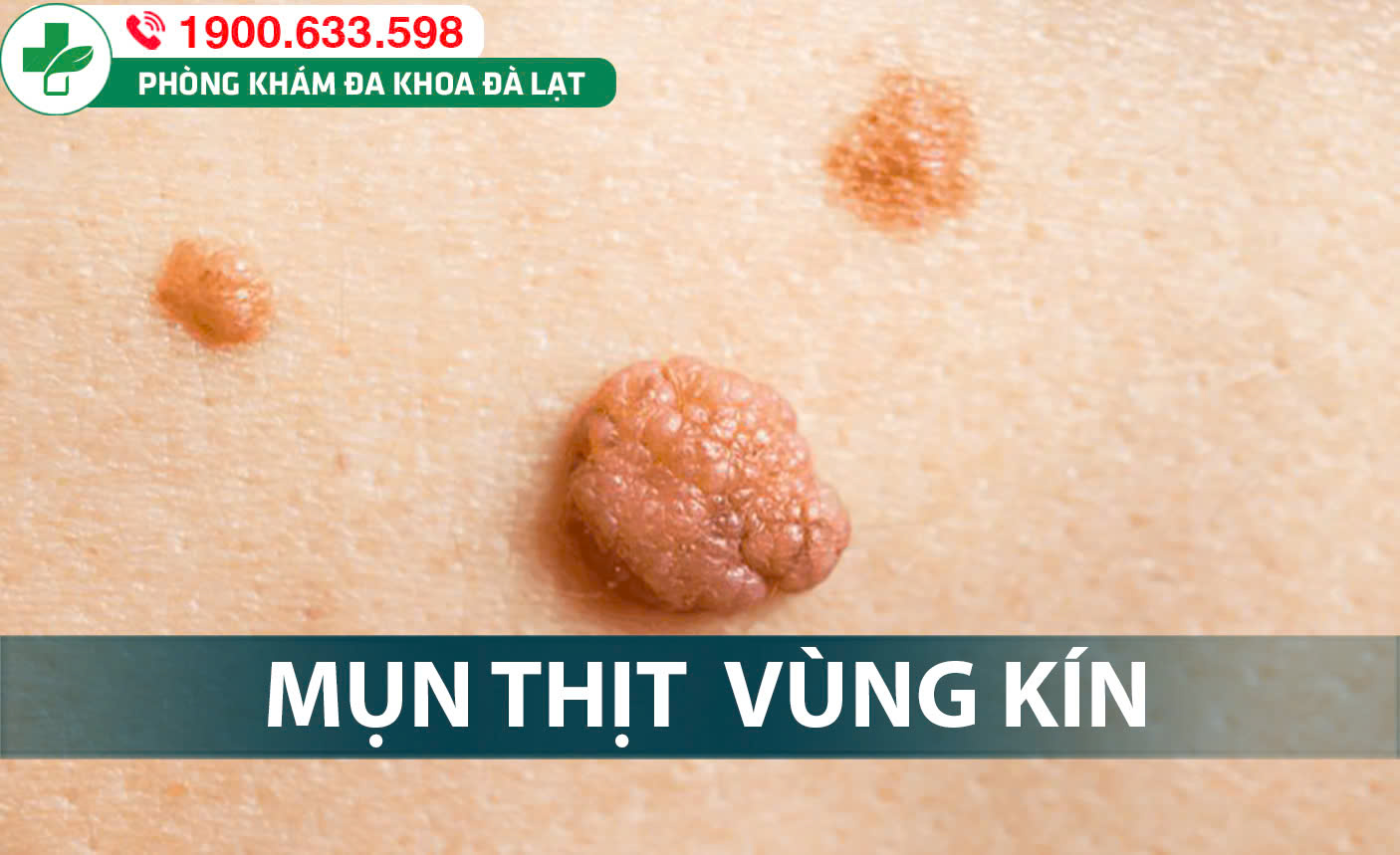 Hình ảnh minh họa